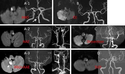 Frontiers | Risk Factors for Long-Term Death After Medullary